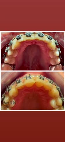 kanvas-97b3cd28-169c-4dfb-bab5-b38f296daed9